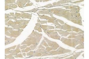 anti-Poly (ADP-Ribose) Polymerase Family, Member 4 (PARP4) (Internal Region) antibody