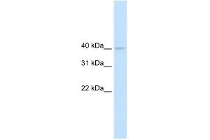NUDT9 antibody used at 0. (NUDT9 antibody)