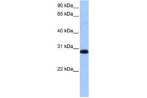 WARS2 antibody used at 1 ug/ml to detect target protein.