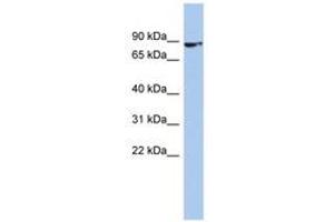 ZNF189 antibody  (C-Term)