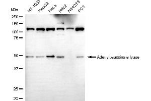 Western blotting analysis using adenylosuccinate lyase antibody (ABIN7797524).