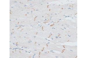 Immunohistochemistry of paraffin-embedded Rat heart using N-Cadherin Polyclonal Antibody at dilution of 1:100 (40x lens). (N-Cadherin antibody)