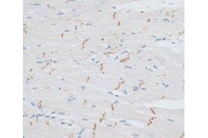 Immunohistochemistry of paraffin-embedded Rat heart using N-Cadherin Polyclonal Antibody at dilution of 1:100 (40x lens). (N-Cadherin antibody)