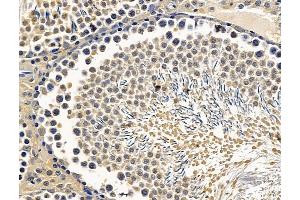 ABIN7096345 and ABIN7100407 at 1/100 staining rat testis tissue by IHC-P. (CEMP1 antibody)