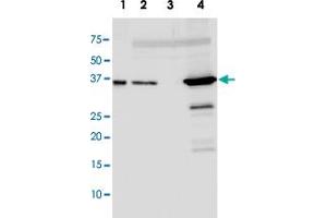 Western blot analysis using RecA polyclonal antibody  at 1:3000 dilution. (RecA antibody)