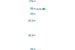 CYP3A5 Protein (AA 1-502) (GST tag)