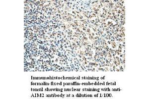 Image no. 1 for anti-Absent in Melanoma 2 (AIM2) antibody (ABIN791198) (AIM2 antibody)