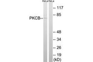 Western blot analysis of extracts from HeLa cells, using PKCB (Ab-661) Antibody. (PKC beta antibody  (AA 622-671))
