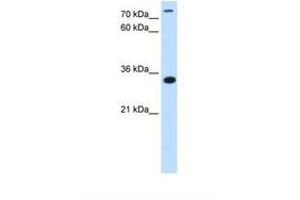 Image no. 1 for anti-TAM41, Mitochondrial Translocator Assembly and Maintenance Protein (TAMM41) (N-Term) antibody (ABIN341337) (TAM41 antibody  (N-Term))