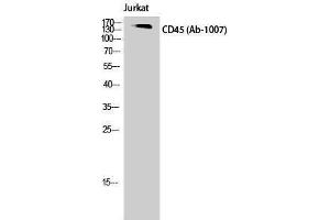 Western Blotting (WB) image for anti-Protein tyrosine Phosphatase, Receptor Type, C (PTPRC) (Thr505) antibody (ABIN3183774)