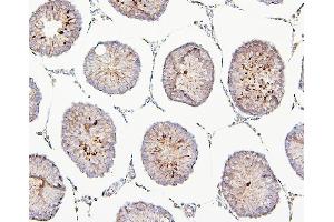 IHC analysis of TEK using anti-TEK antibody (ABIN7600762). (TEK antibody  (AA 23-616))