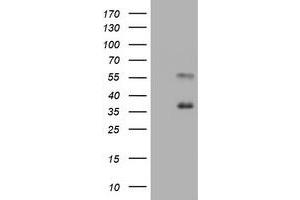 Image no. 2 for anti-Mucin 1 (MUC1) antibody (ABIN1499599) (MUC1 antibody)