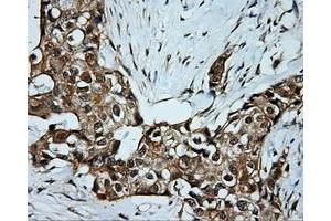 Immunohistochemical staining of paraffin-embedded Kidney tissue using anti-SRR mouse monoclonal antibody.