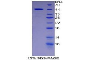SDS-PAGE (SDS) image for Cholecystokinin (CCK) (AA 1-115) protein (His tag,GST tag) (ABIN2122619) (Cholecystokinin Protein (CCK) (AA 1-115) (His tag,GST tag))