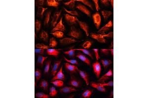 Immunofluorescence analysis of U2OS cells using MB antibody (ABIN1680748, ABIN3017668, ABIN3017669 and ABIN6220205) at dilution of 1:100. (MAP1B antibody  (AA 1820-2100))