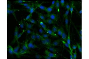 Immunofluorescence (IF) image for anti-Phospholipase C beta 4 (PLCb4) (AA 752-961) antibody (ABIN968583) (Phospholipase C beta 4 antibody  (AA 752-961))