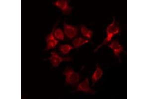 ABIN6267543 staining 293 by IF/ICC. (Tuberin antibody  (pThr1462))