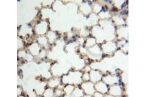 IHC-P analysis of Lung tissue, with DAB staining. (IL22RA2 antibody  (AA 31-223))