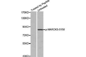 Western blot analysis of extracts from 3T3 cells using Phospho-MARCKS-S158 antibody.