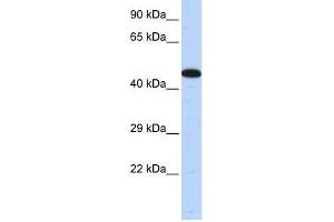Human Muscle; WB Suggested Anti-AKAP5 Antibody Titration: 0. (AKAP5 antibody  (Middle Region))