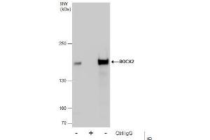 Immunoprecipitation (IP) image for anti-rho-Associated, Coiled-Coil Containing Protein Kinase 2 (ROCK2) antibody (ABIN2855440)
