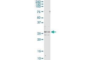 Immunoprecipitation of CFC1 transfected lysate using anti-CFC1 monoclonal antibody and Protein A Magnetic Bead , and immunoblotted with CFC1 MaxPab rabbit polyclonal antibody. (CFC1 antibody  (AA 27-93))