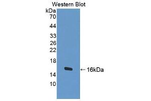 Western blot analysis of recombinant Human BCHE.