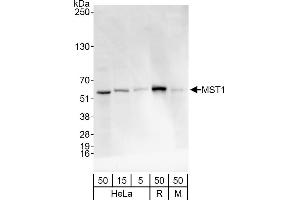 Western Blotting (WB) image for anti-serine/threonine Kinase 4 (STK4) (AA 375-425) antibody (ABIN7452213)