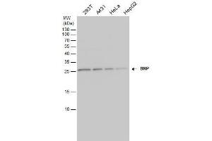 WB Image BNP antibody detects BNP protein by western blot analysis.