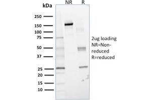 SDS-PAGE Analysis Purified Lactoylglutathione Lyase Mouse Monoclonal Antibody (CPTC-GLO1-1).