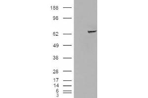 Image no. 2 for anti-Insulin-Like Growth Factor 2 mRNA Binding Protein 2 (IGF2BP2) (C-Term) antibody (ABIN374940) (IGF2BP2 antibody  (C-Term))
