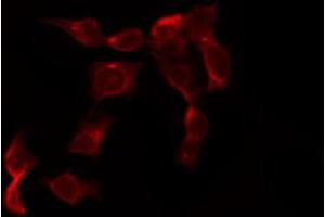 ABIN6267265 staining SK-OV3 by IF/ICC. (EGFR antibody  (pTyr1197))