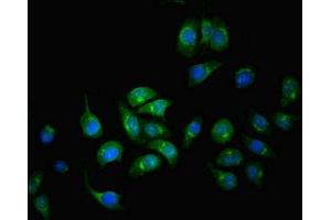Immunofluorescent analysis of A549 cells using ABIN7148620 at dilution of 1:100 and Alexa Fluor 488-congugated AffiniPure Goat Anti-Rabbit IgG(H+L) (SERPINA6 antibody  (AA 136-405))