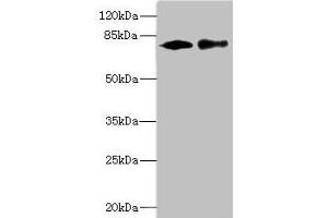 Western blot All lanes: CALCOCO1 antibody at 1.