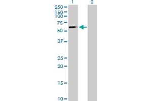 Western Blot analysis of ZNF280B expression in transfected 293T cell line by ZNF280B MaxPab polyclonal antibody. (ZNF280B antibody  (AA 1-543))