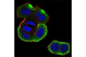 Immunofluorescence (IF) image for anti-Casein Kinase 2, beta (CSNK2B) (AA 1-215) antibody (ABIN5542448)