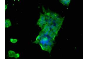 Immunofluorescence staining of 293 cells with ABIN7154578 at 1:166, counter-stained with DAPI. (GTPBP1 antibody  (AA 562-669))