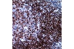 Immunohistochemical analysis of XRCC3 staining in human tonsil formalin fixed paraffin embedded tissue section. (XRCC3 antibody)