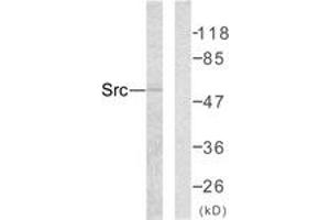 Western blot analysis of extracts from COLO205 cells, using Src (Ab-418) Antibody. (Src antibody  (AA 386-435))