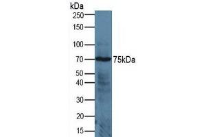 Figure. (ADAM17 antibody  (AA 226-473))