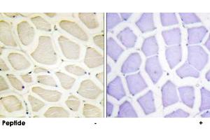 Immunohistochemistry analysis of paraffin-embedded human skeletal muscle tissue using COL20A1 polyclonal antibody . (COL20A1 antibody  (C-Term))