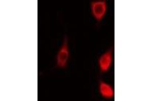 ABIN6278263 staining  NIH-3T3 cells by IF/ICC. (MAPKAP Kinase 2 antibody  (C-Term))