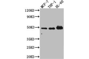 Western Blot Positive WB detected in: MCF-7 whole cell lysate, THP-1 whole cell lysate, HL-60 whole cell lysate All lanes: Vitamin D antibody at 1:1000 Secondary Goat polyclonal to rabbit IgG at 1/50000 dilution Predicted band size: 49, 54 kDa Observed band size: 49 kDa (Recombinant Vitamin D Receptor antibody)