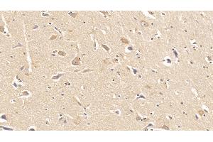 Detection of DMD in Human Cerebrum Tissue using Monoclonal Antibody to Dystrophin (DMD) (Dystrophin antibody  (AA 253-597))