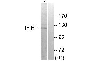 Western blot analysis of extracts from Jurkat cells, using IFIH1 antibody. (IFIH1 antibody)