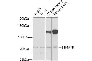 Western blot analysis of extracts of various cell lines, using SEMB Antibody (ABIN6132644, ABIN6147511, ABIN6147512 and ABIN6222774) at 1:1000 dilution.