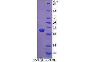 SDS-PAGE analysis of Human FGF22 Protein.