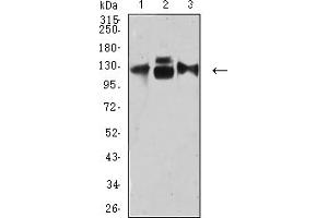 Western blot analysis using CD49C mouse mAb against HepG2 (1), HUVEC (2), and HUVE-12 (3) cell lysate.