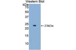 Detection of Recombinant NCF2, Mouse using Polyclonal Antibody to Neutrophil Cytosolic Factor 2 (NCF2) (NCF2 antibody  (AA 354-525))