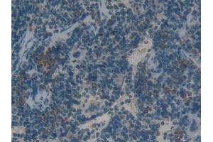 Immunohistochemistry (IHC) image for anti-High Mobility Group Box 1 (HMGB1) (AA 1-215) antibody (ABIN7431746)